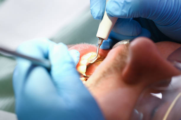 Best Emergency Root Canal Therapy in Ajo, AZ